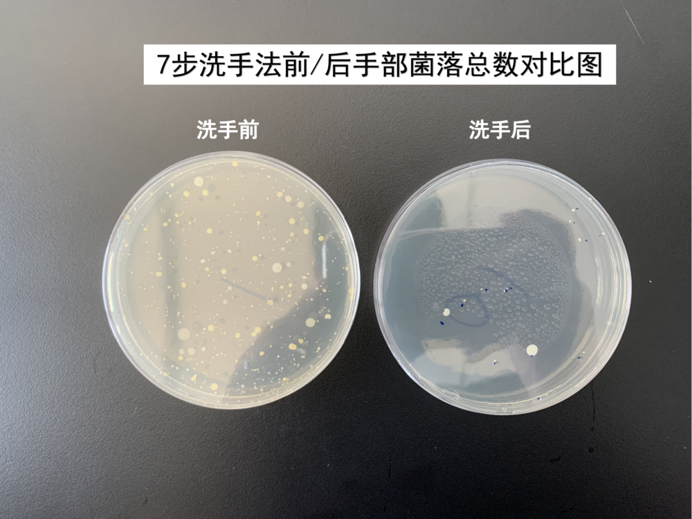 不洗手的细菌图片真实图片